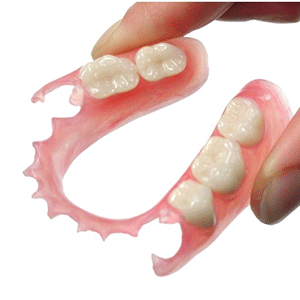 ノンクラスプデンチャー